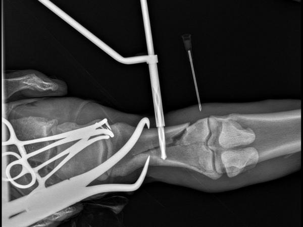 Nora-36