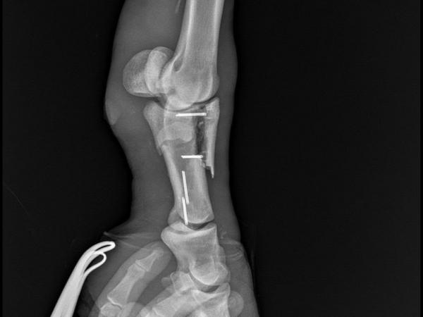 Nora-53