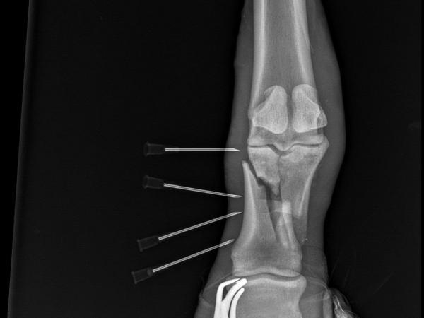 Nora-55