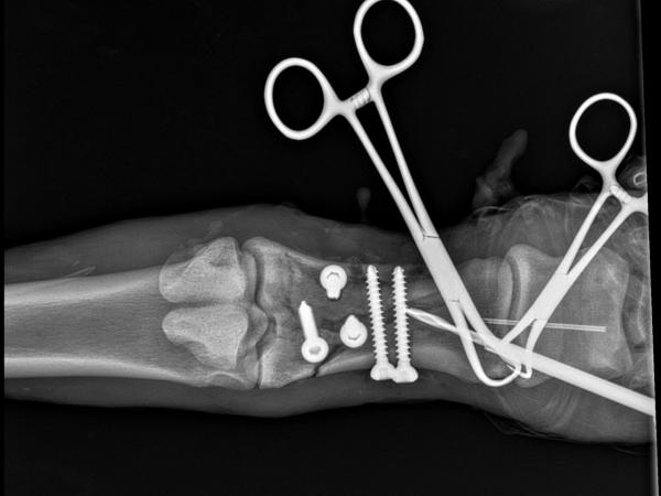 Nora-35